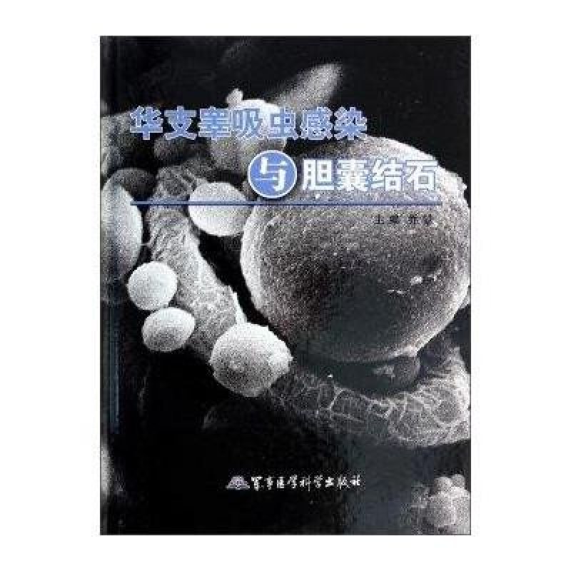 华支睾吸虫感染与胆囊结石